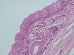 MISSING THUMBNAIL